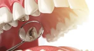 DES d'Odontologie Conservatrice